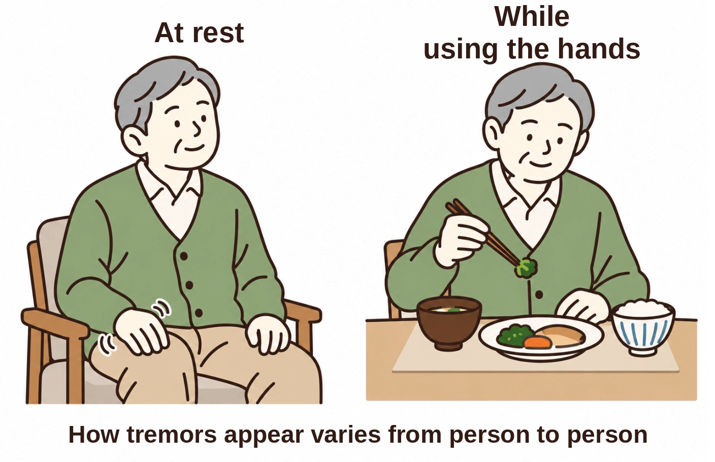 At rest and while using the hands. How tremors appear varies from person to person.